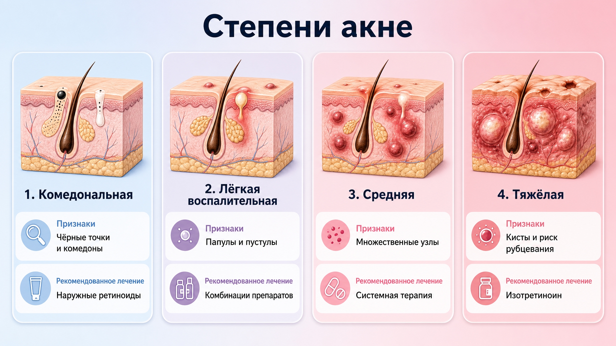 Степени акне: комедональная, легкая воспалительная, средняя, тяжелая